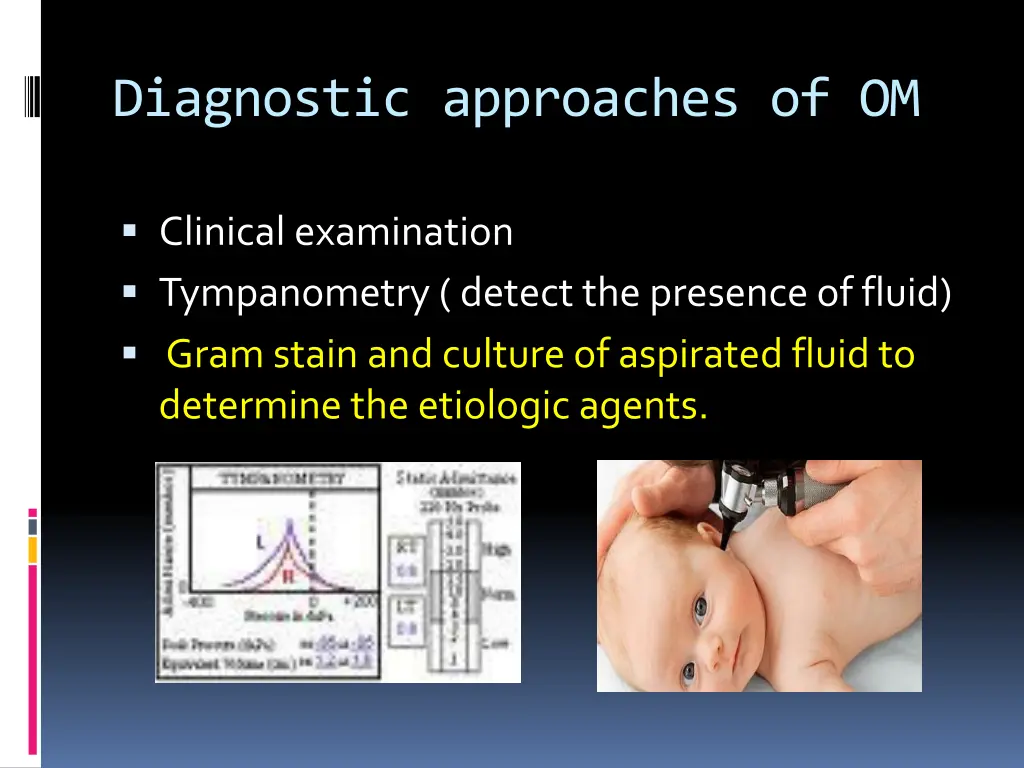 diagnostic approaches of om