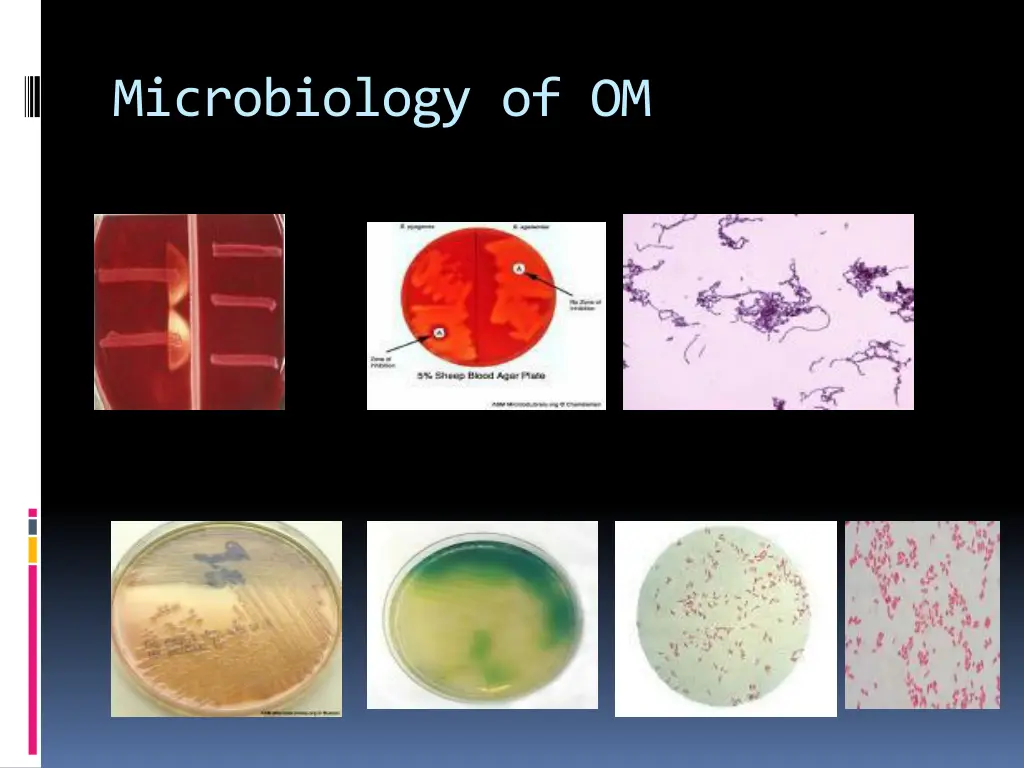 microbiology of om 1