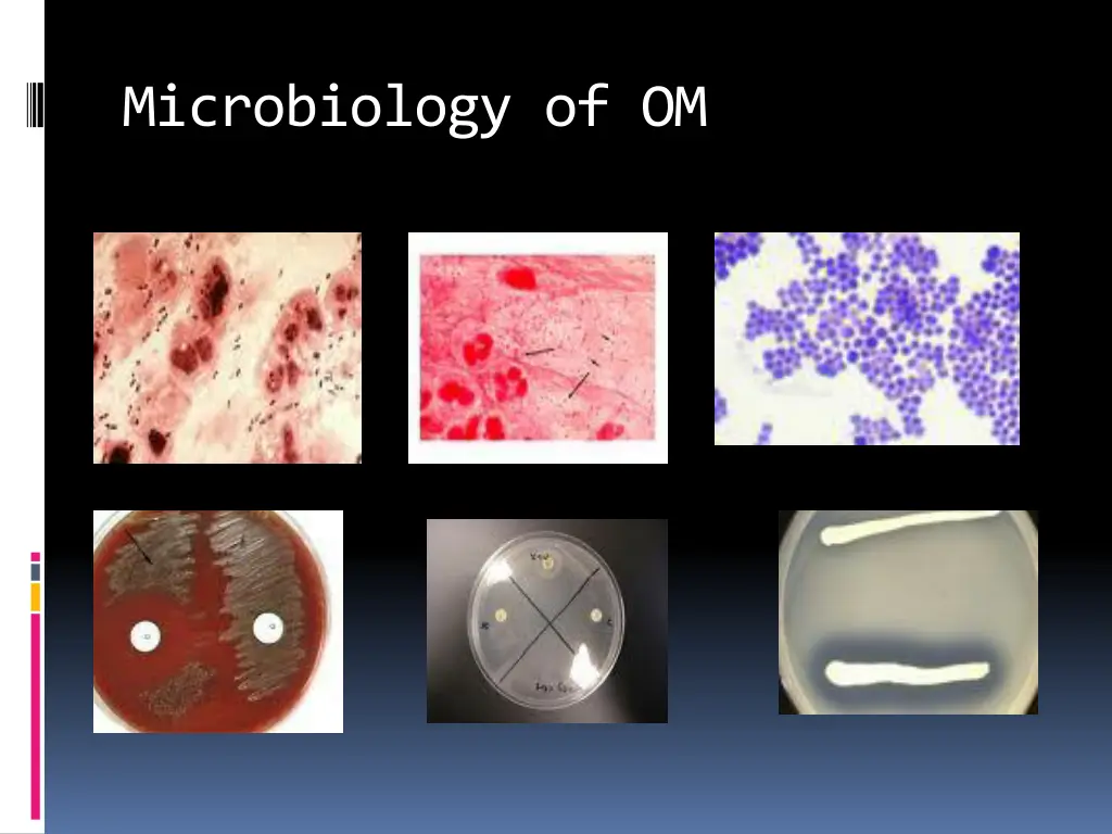 microbiology of om