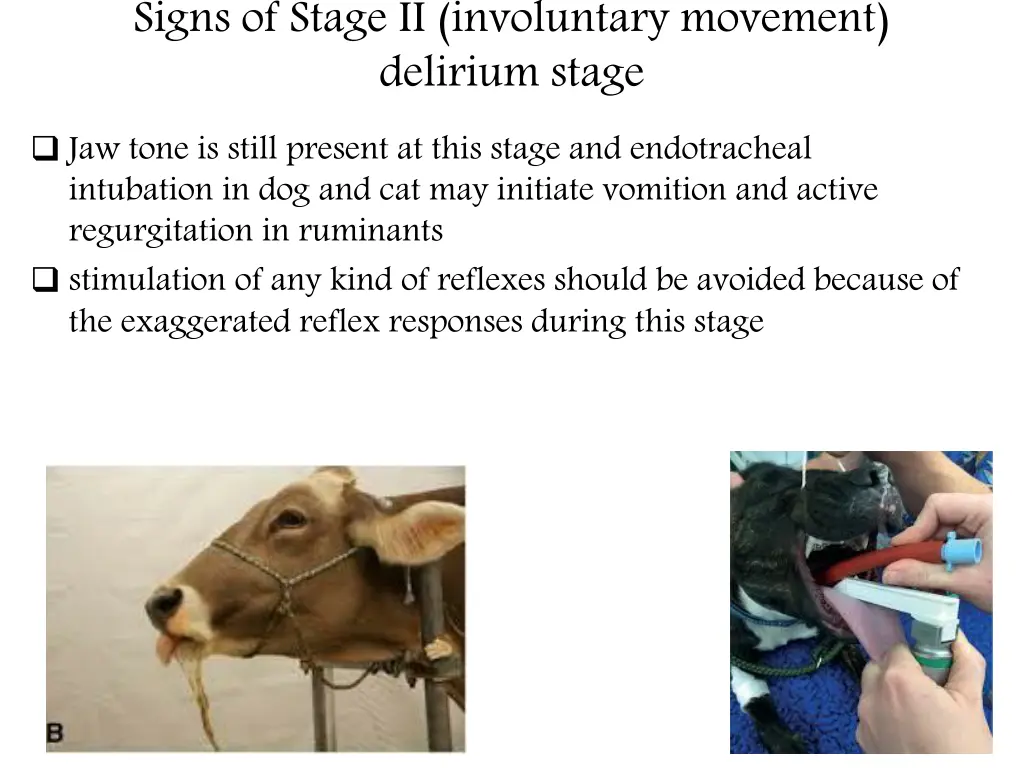 signs of stage ii involuntary movement delirium 1