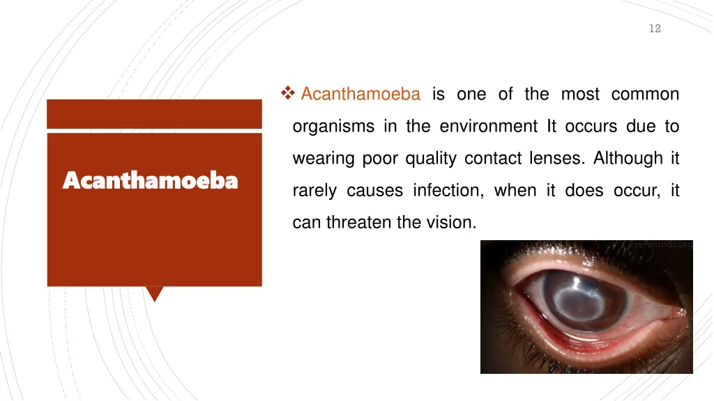 slide12