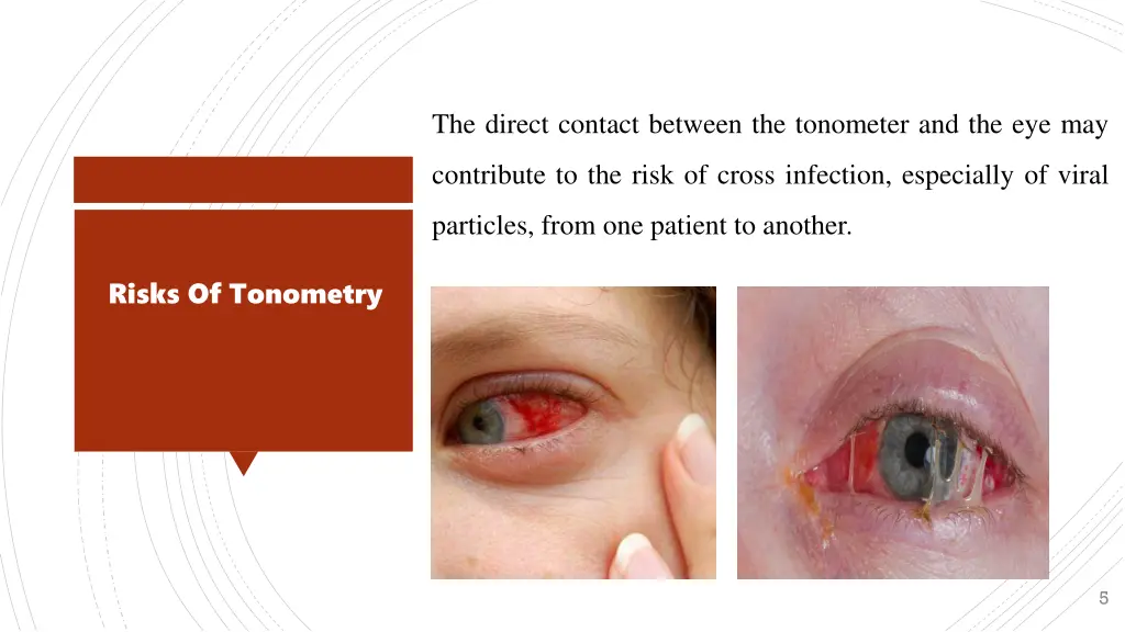 the direct contact between the tonometer
