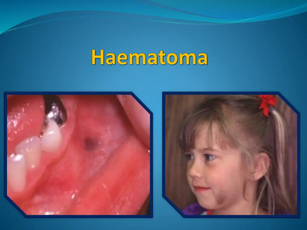 slide4