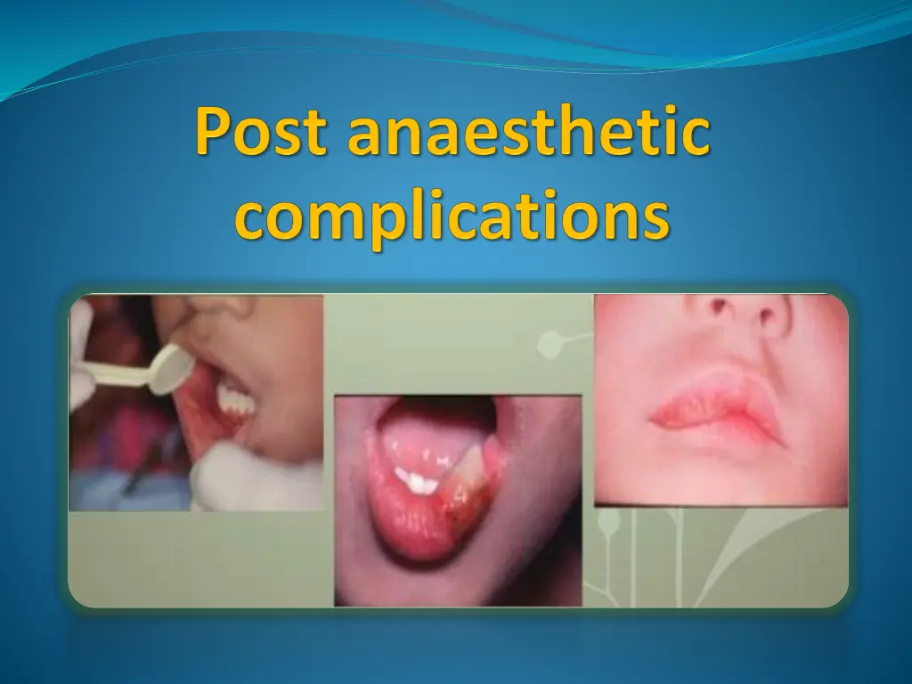 slide6