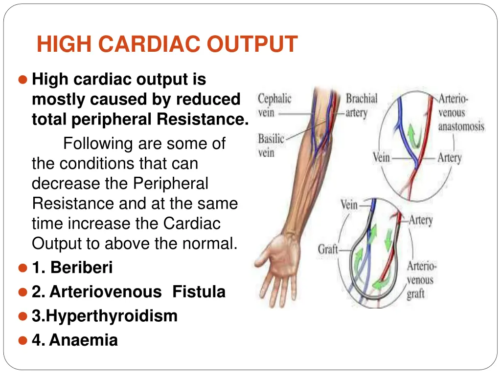 high cardiac output