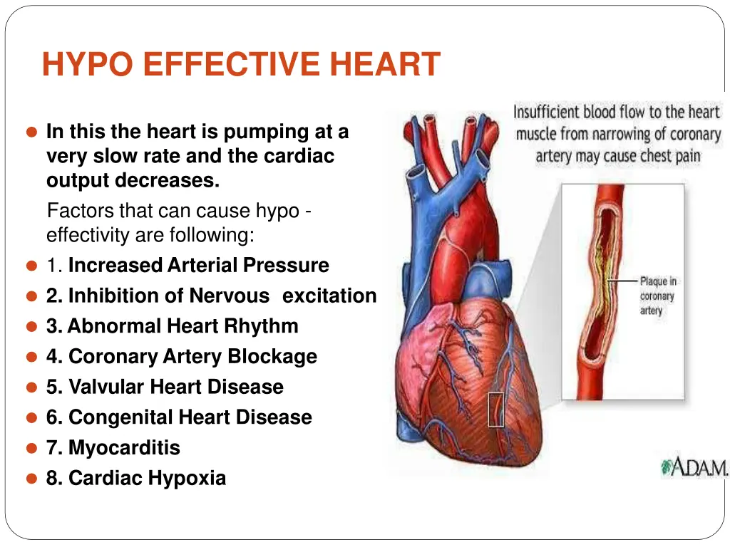 hypo effective heart