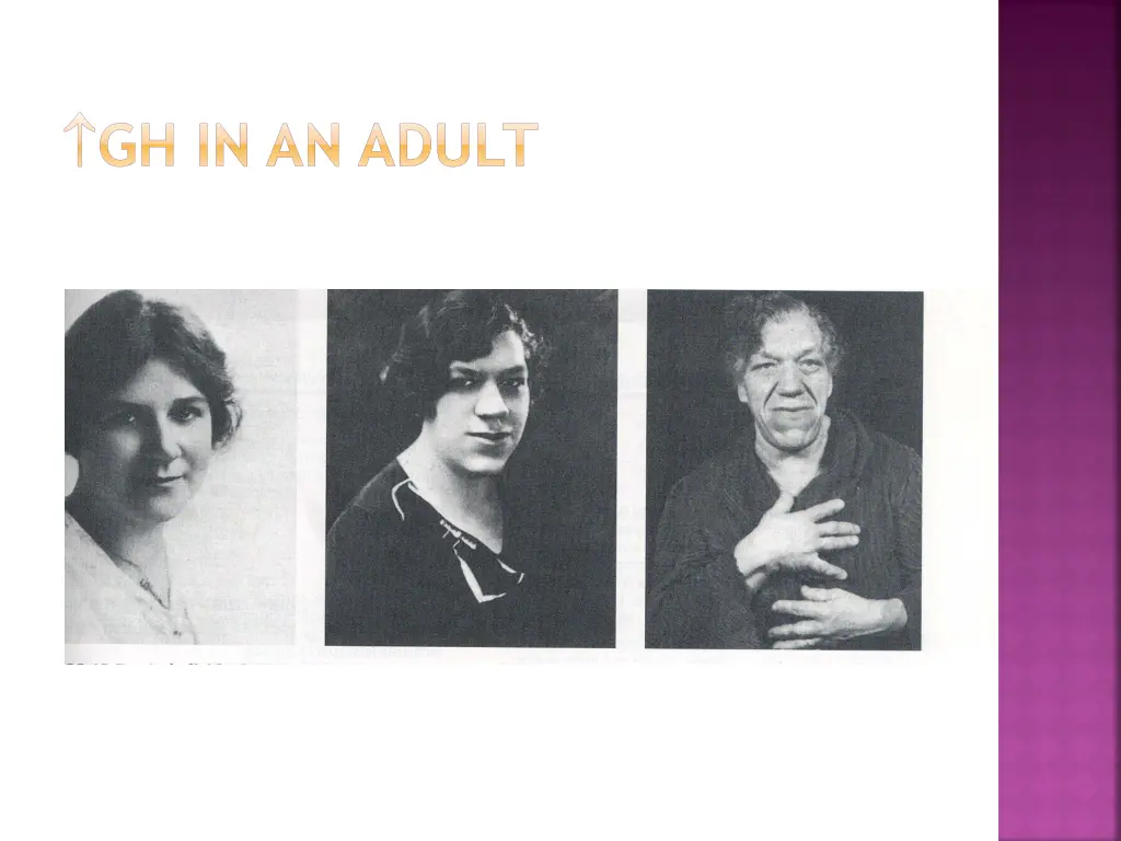 gh in an adult