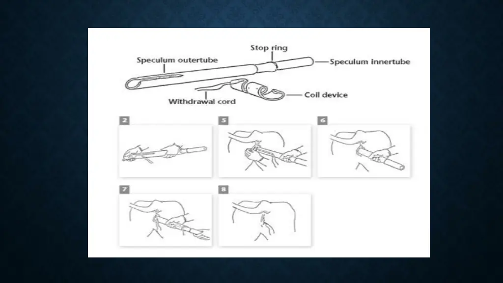 slide9