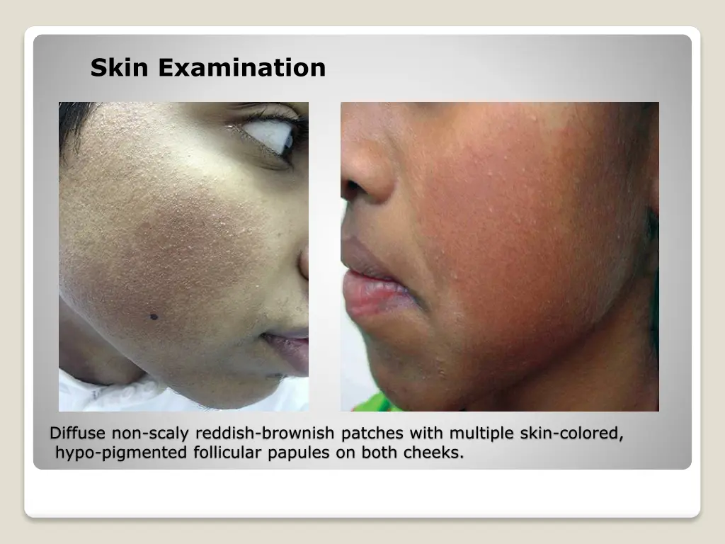 skin examination