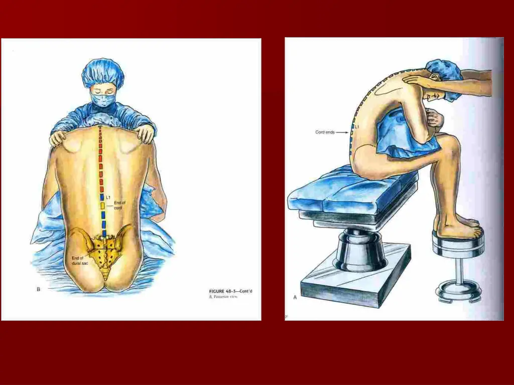 slide13