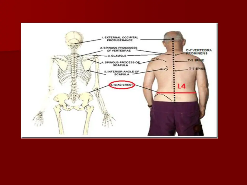 slide15