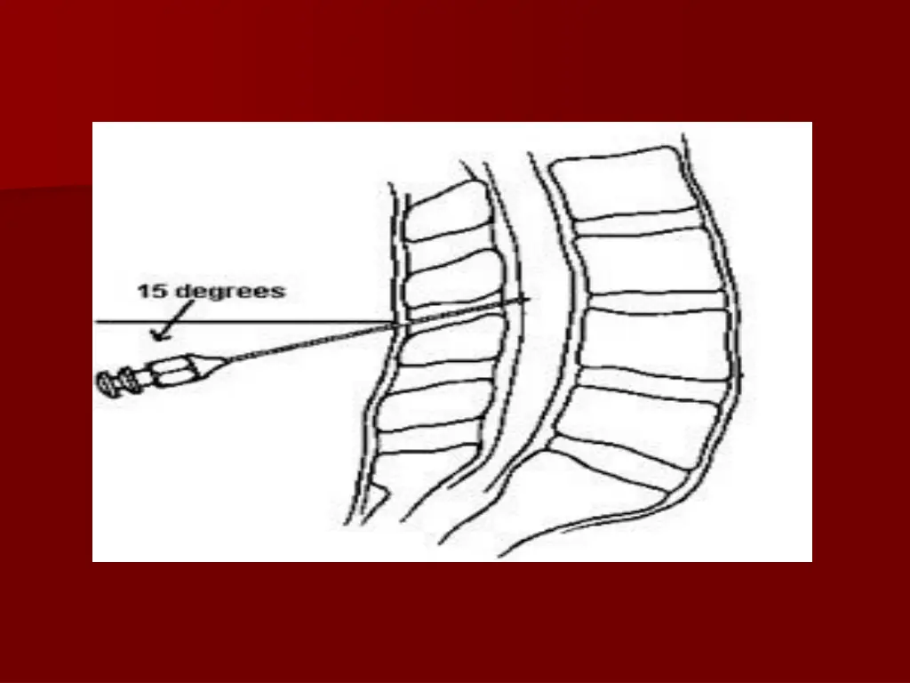 slide22