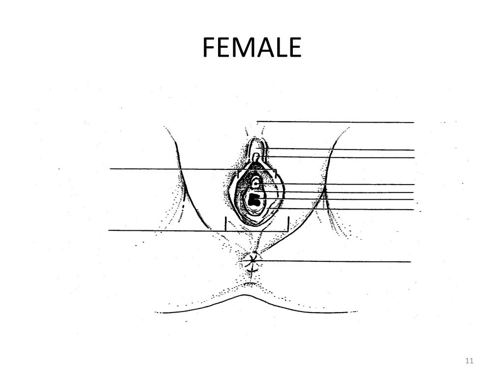 female