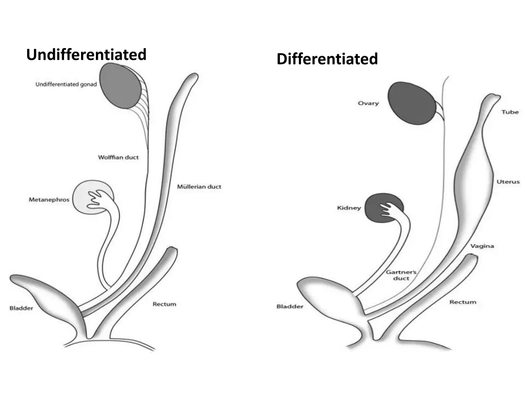 undifferentiated