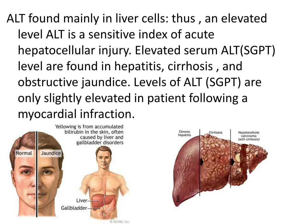 alt found mainly in liver cells thus an elevated