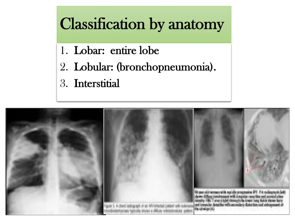 classification by anatomy classification