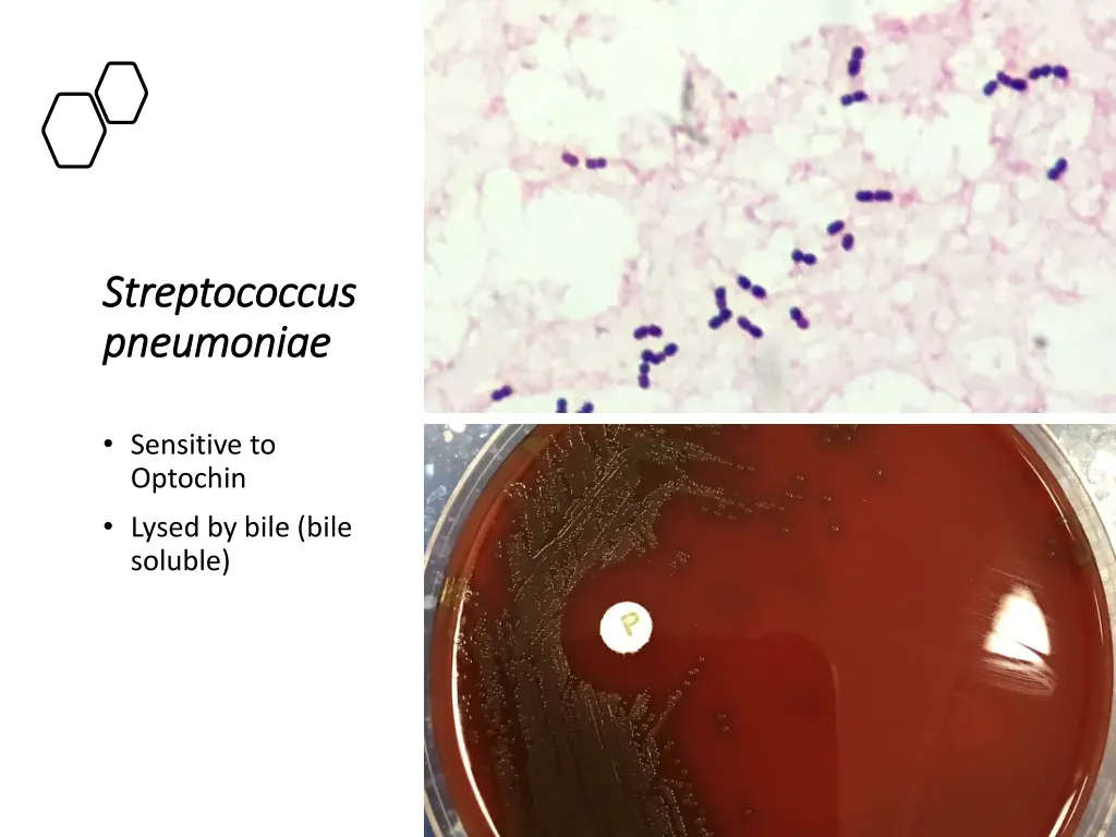 streptococcus streptococcus pneumoniae pneumoniae