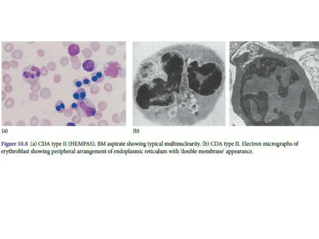 slide26