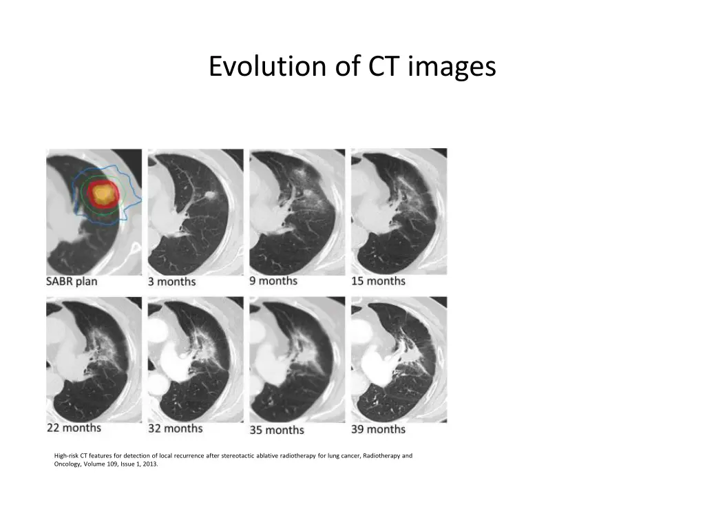 evolution of ct images