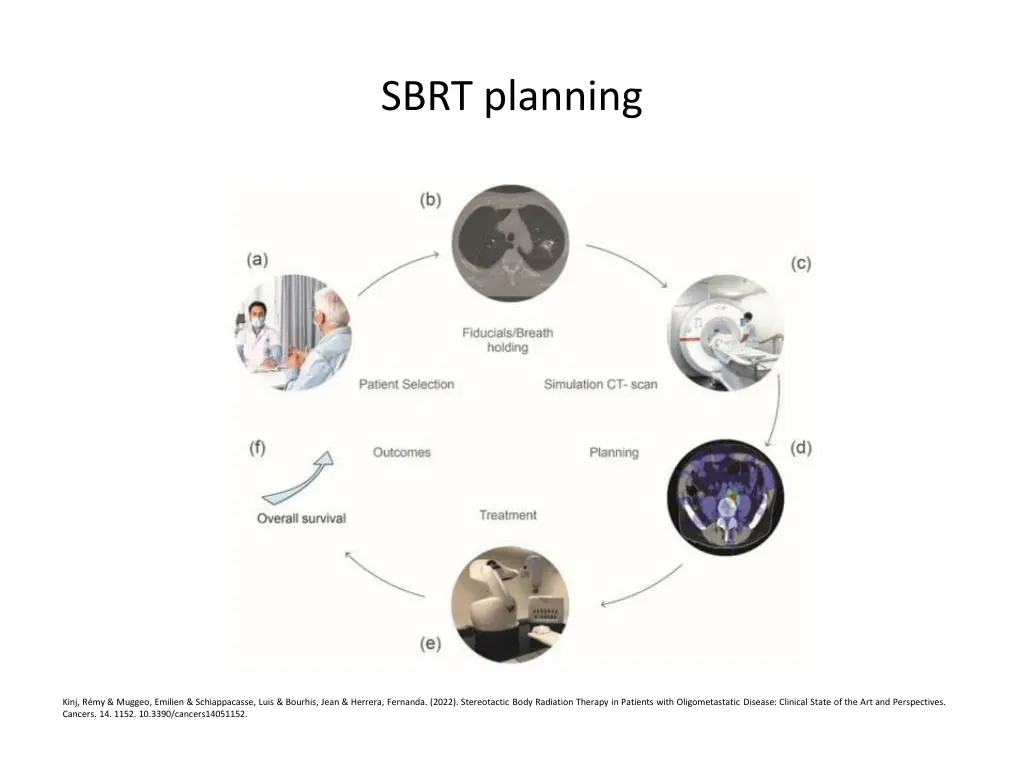 sbrt planning