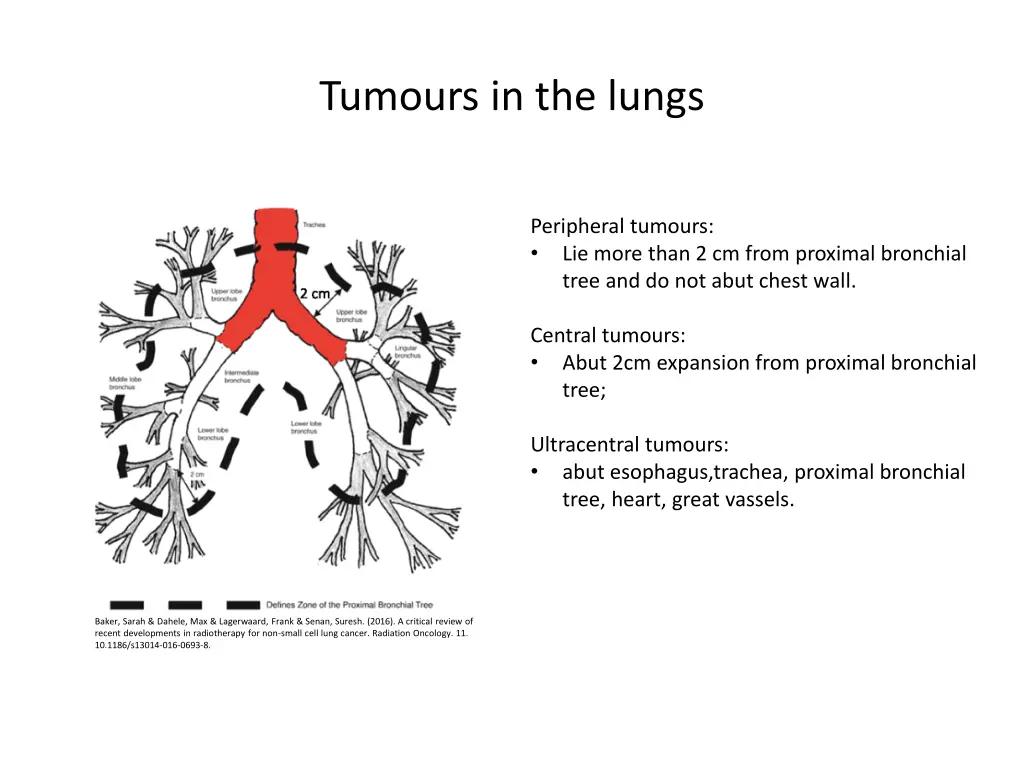tumours in the lungs