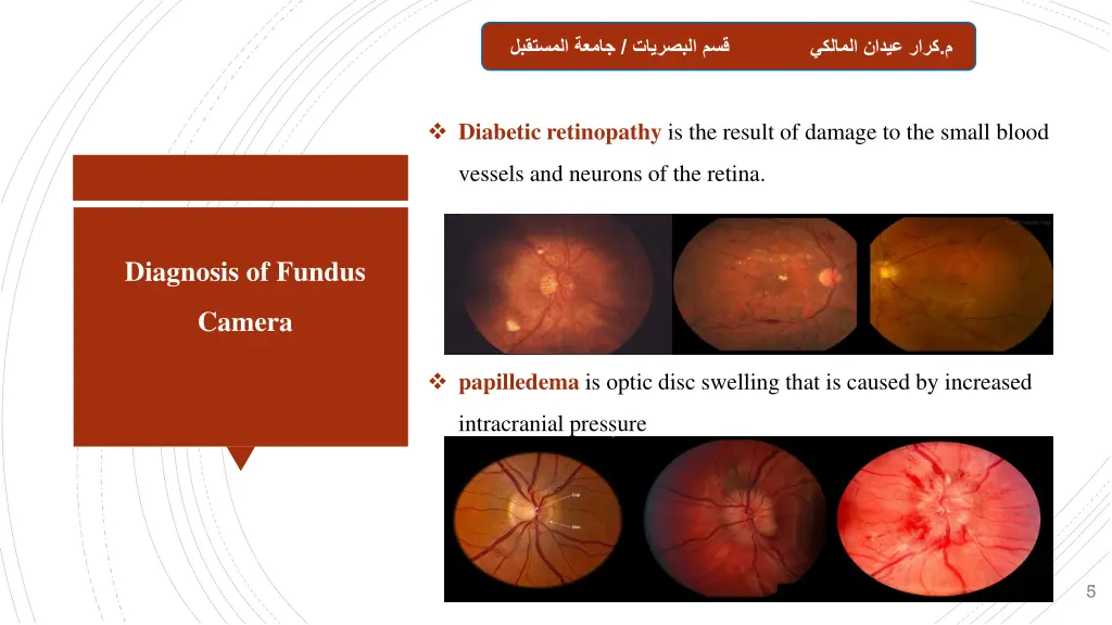 slide5