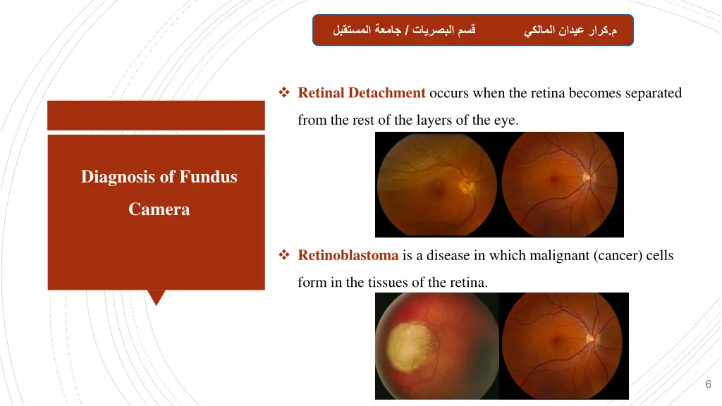 slide6
