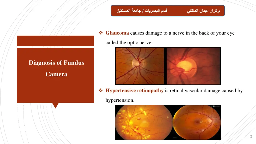 slide7