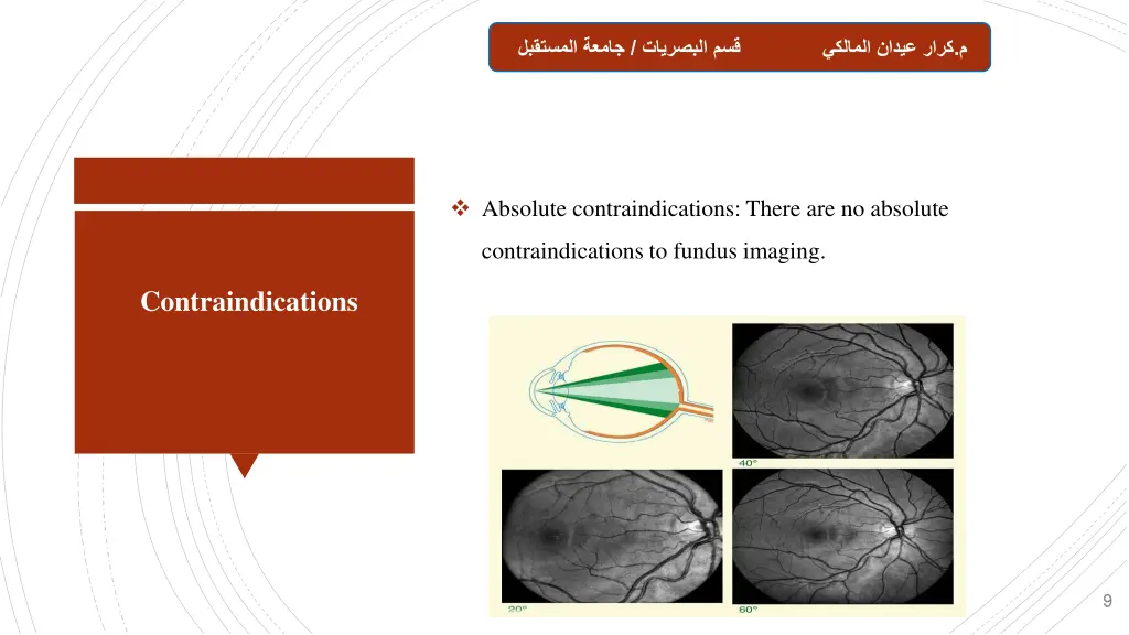 slide9