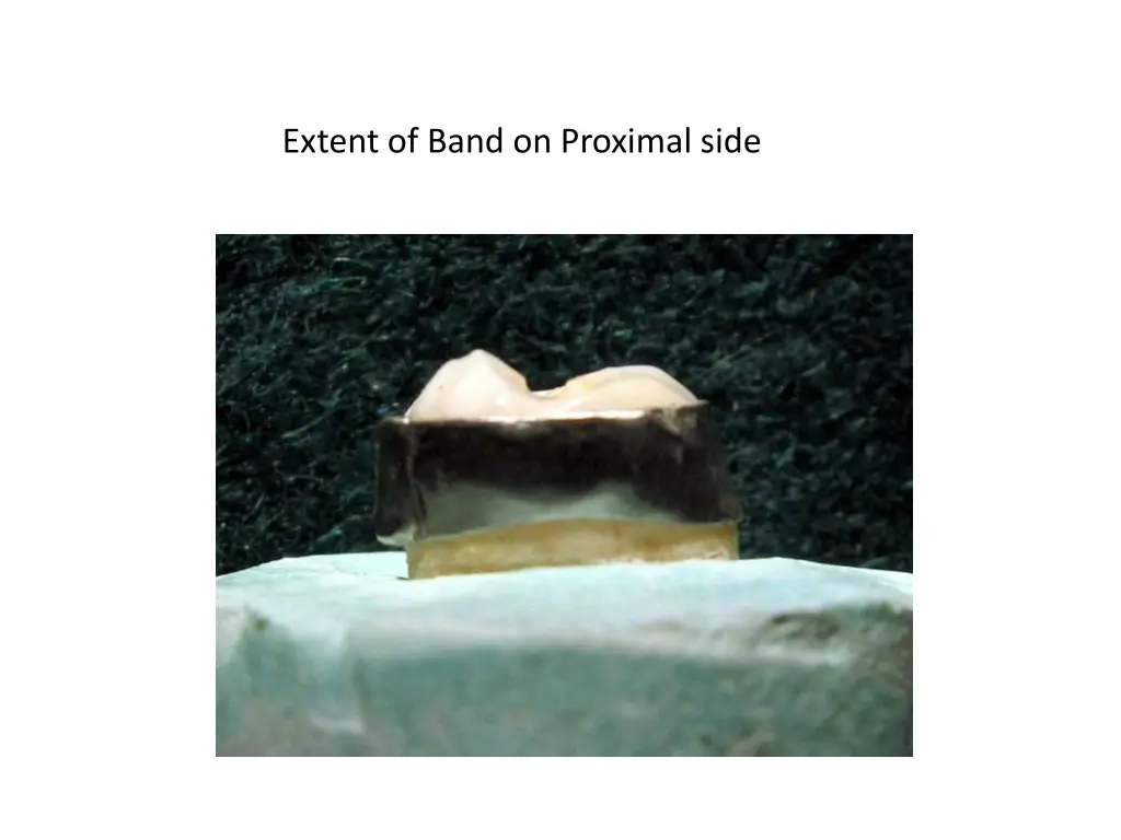 extent of band on proximal side