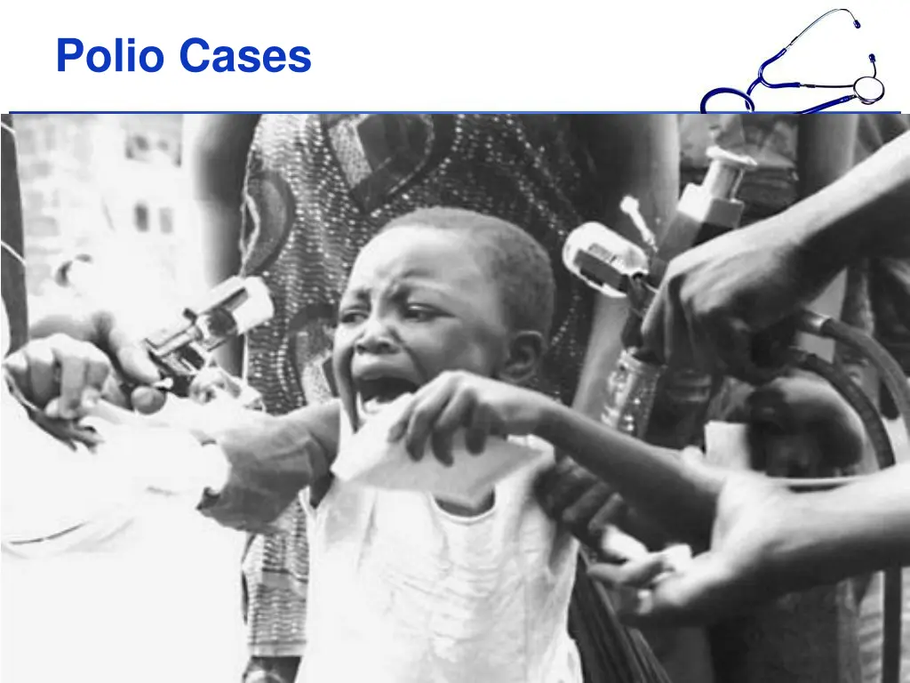 polio cases
