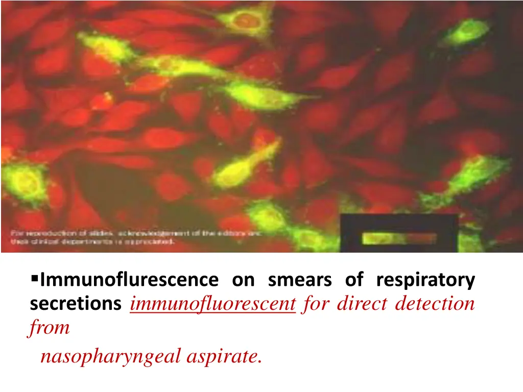 immunoflurescence on smears of respiratory