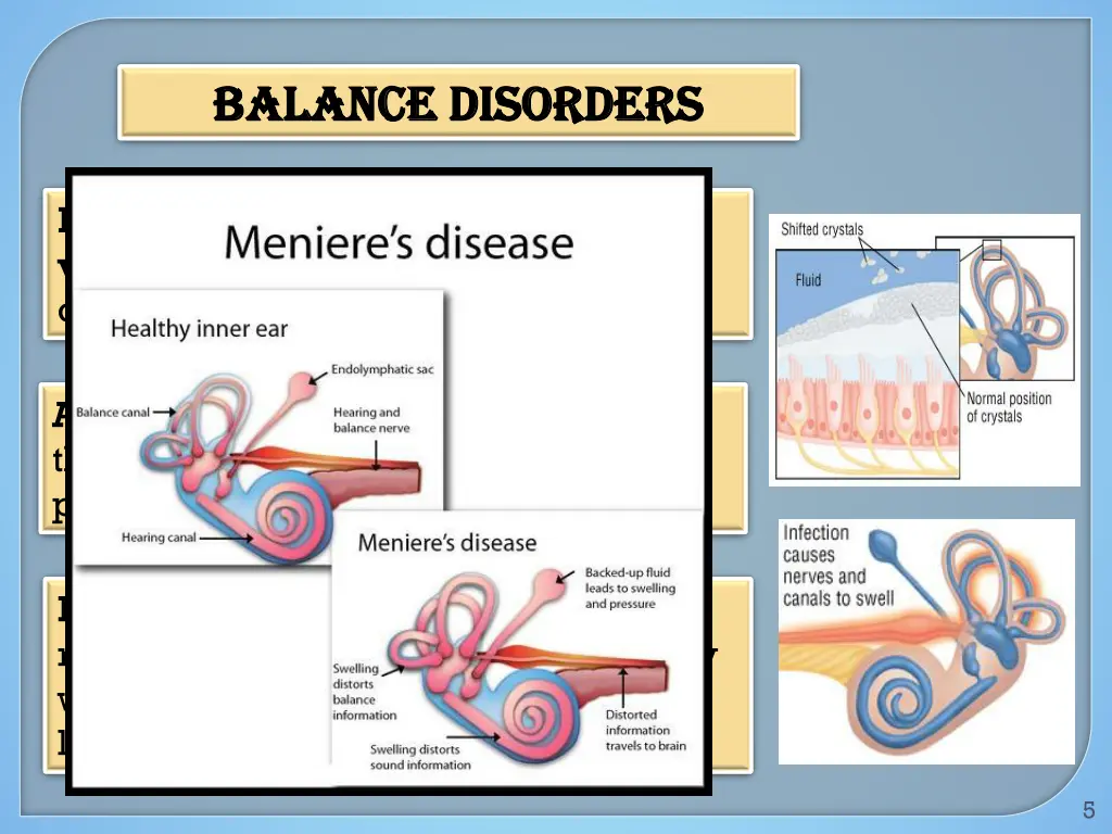 balance disorders balance disorders