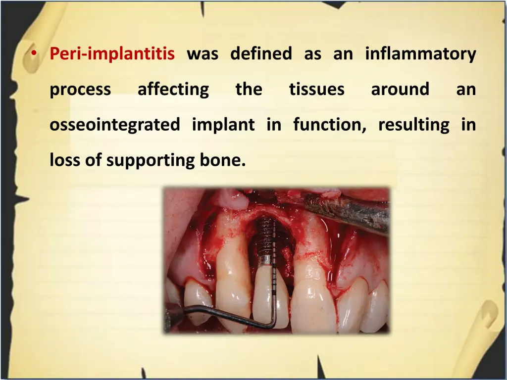 peri implantitis was defined as an inflammatory