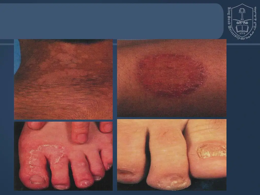slide9