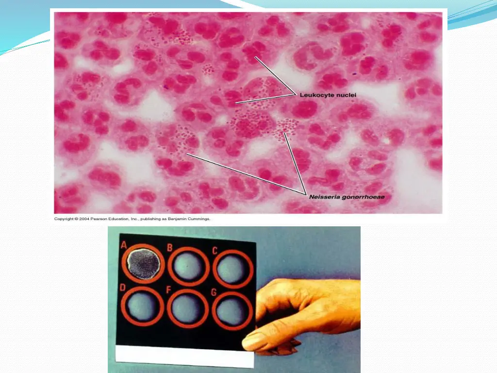 slide17