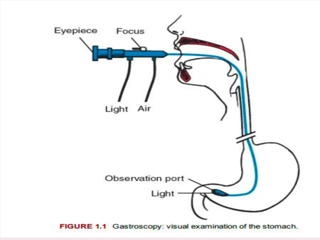 slide9
