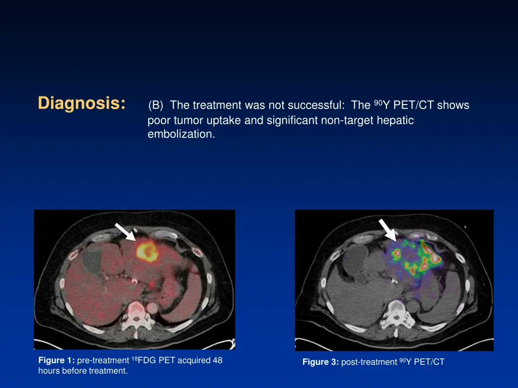 diagnosis b the treatment was not successful