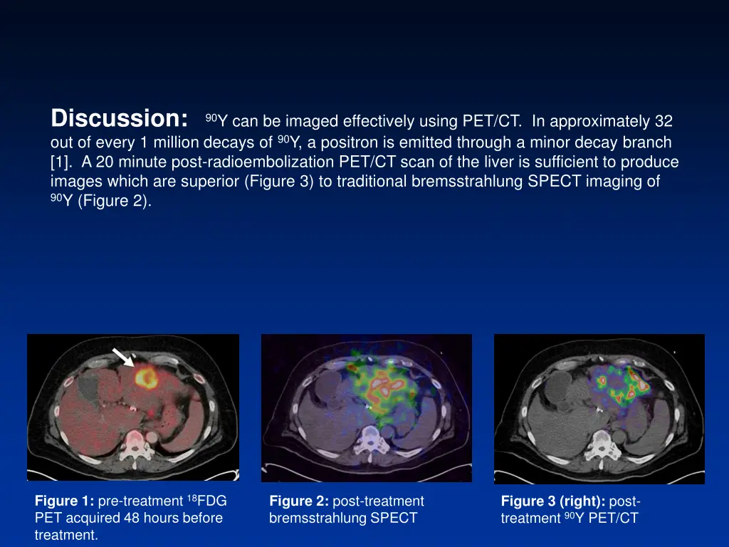 discussion 90 y can be imaged effectively using
