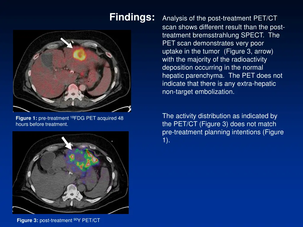 findings analysis of the post treatment 1