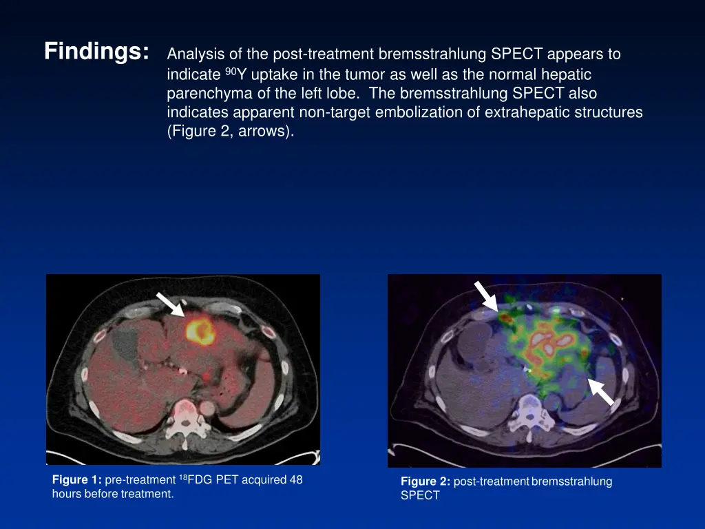 findings analysis of the post treatment