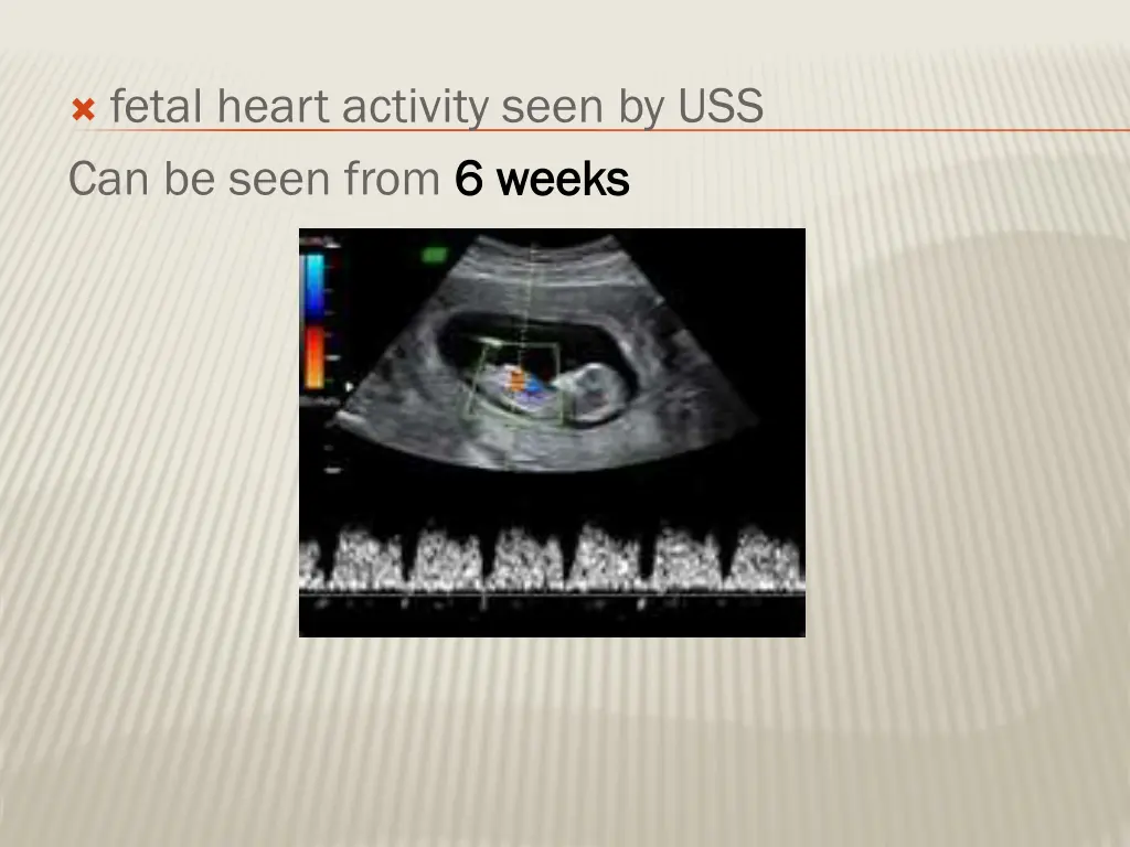 fetal heart activity seen by uss can be seen from