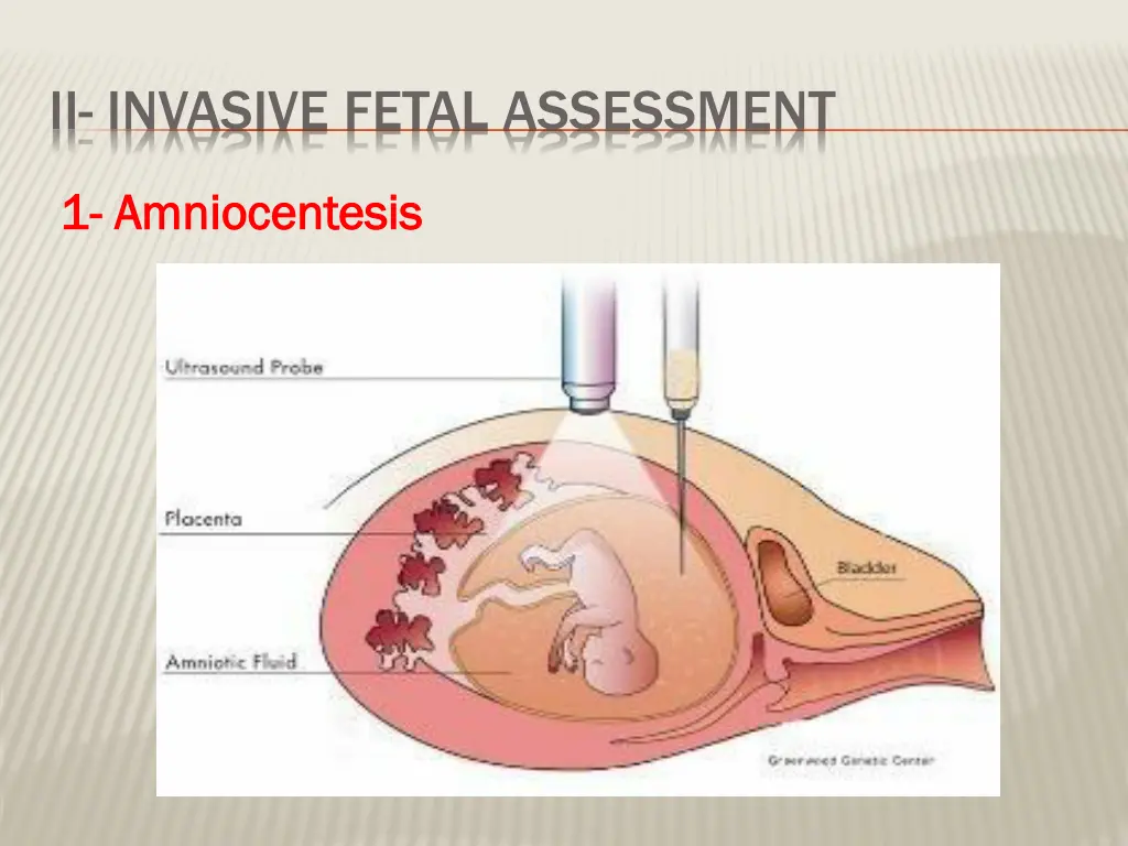 ii invasive fetal assessment