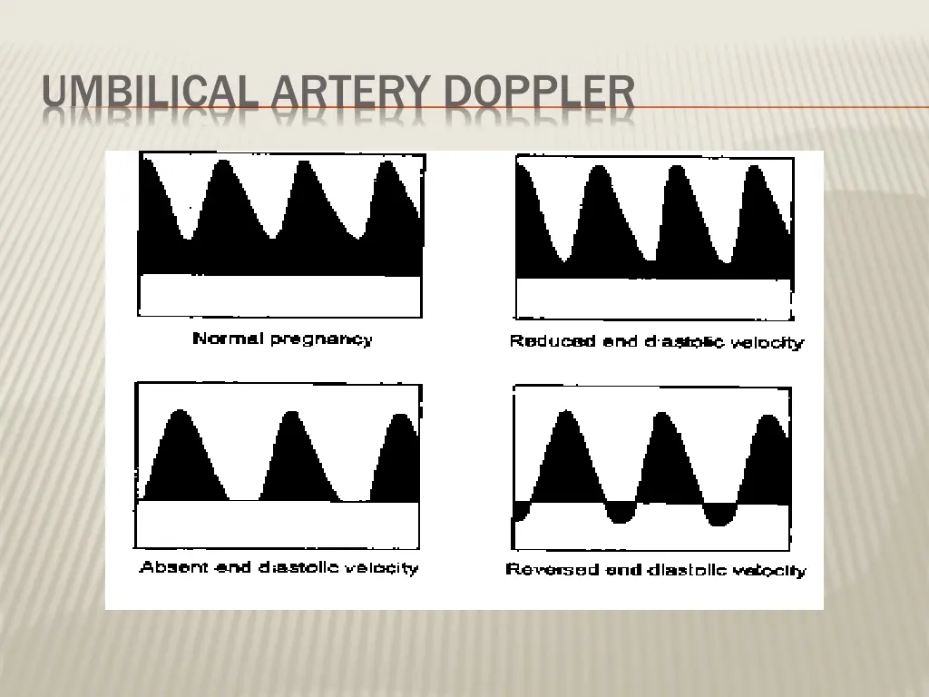 umbilical artery doppler