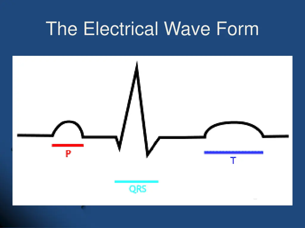 the electrical wave form