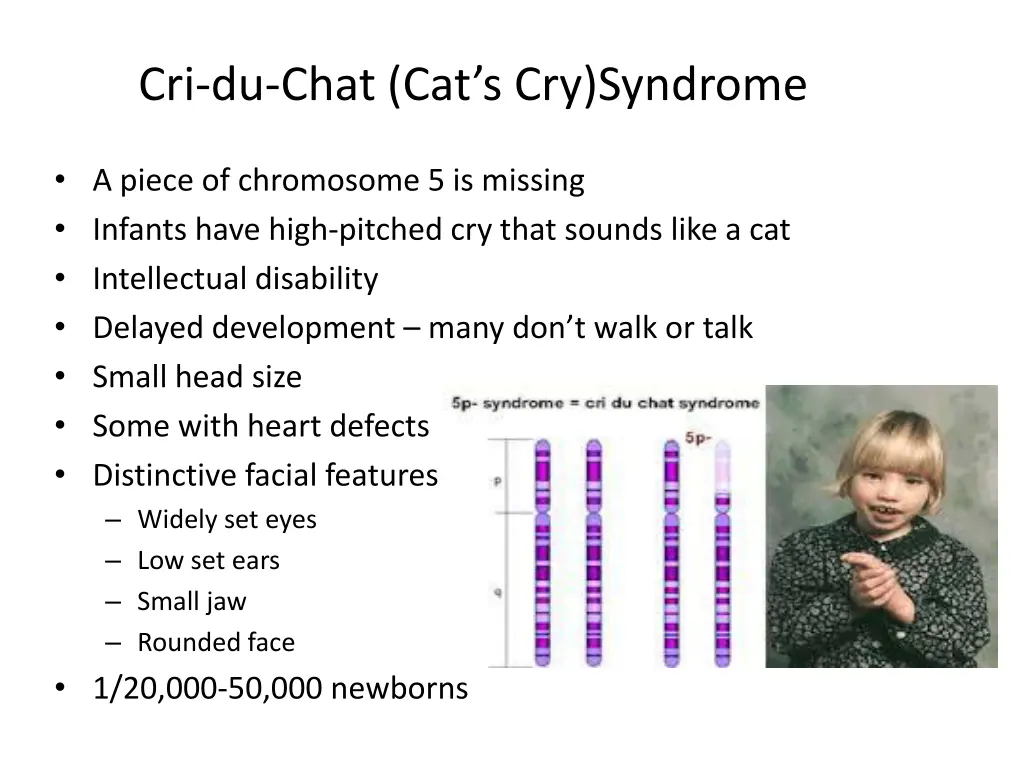 cri du chat cat s cry syndrome