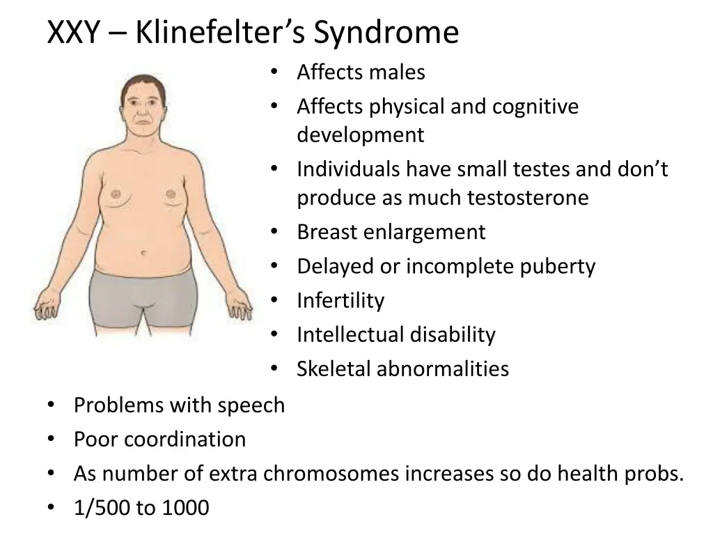 xxy klinefelter s syndrome