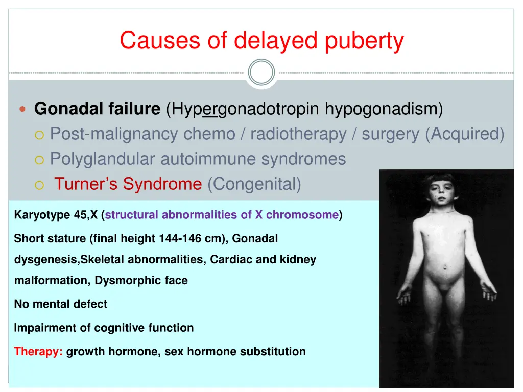 causes of delayed puberty