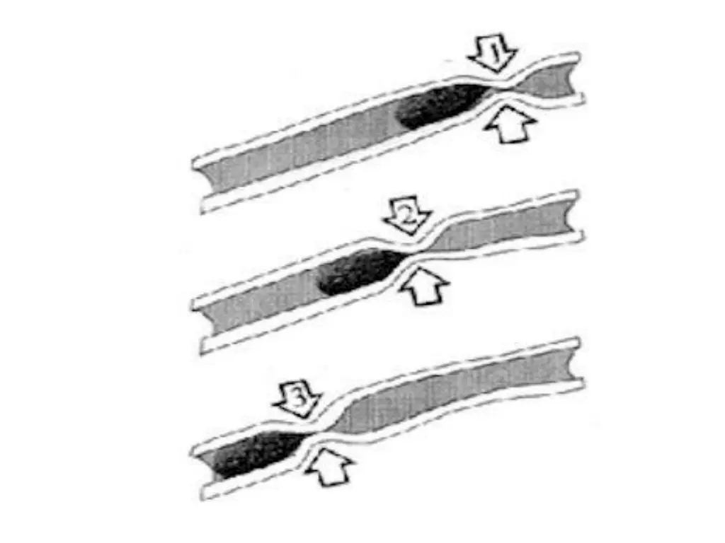 slide16