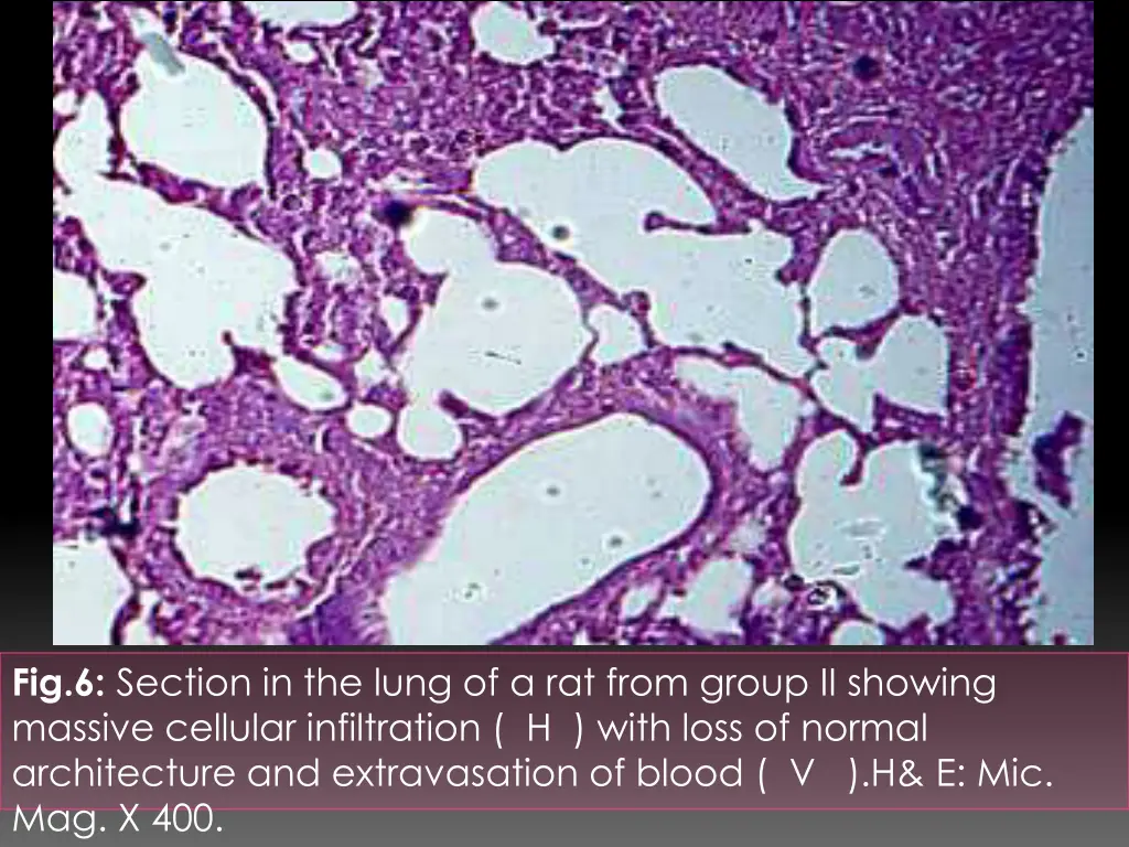 fig 6 section in the lung of a rat from group